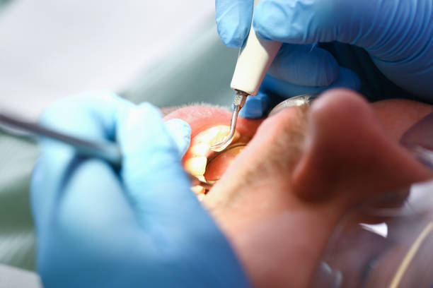 Best Emergency Wisdom Teeth Removal in Mount Healthy Heights, OH